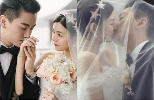 这部位若“发黑”，“大肠病变”可能在靠近，不妨多做3事早预防